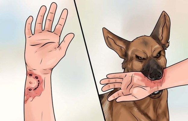 Bị chó cắn vào tay thì đánh con số gì?